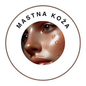 Mastna koža