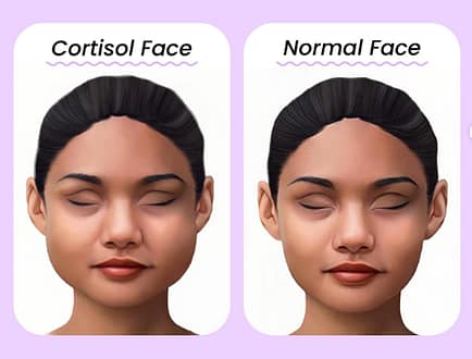 Cortisol face: Kako prepoznaš stresno zabuhlost in jo odpraviš?