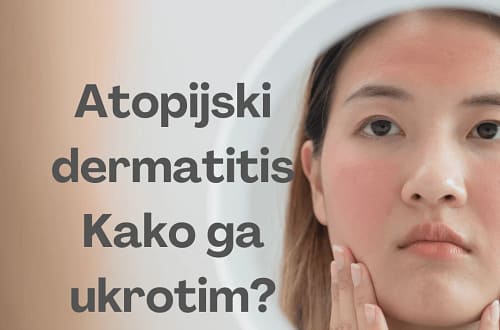Atopijski dermatitis Kako ga ukrotim 1 e1739121574672