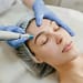 lasersko odstranjevanje dlak zares trajno? Dermatologi razkrivajo resnico o rezultatih, vplivu hormonov in svetujejo, kako doseči gladko kožo, ki traja leta.